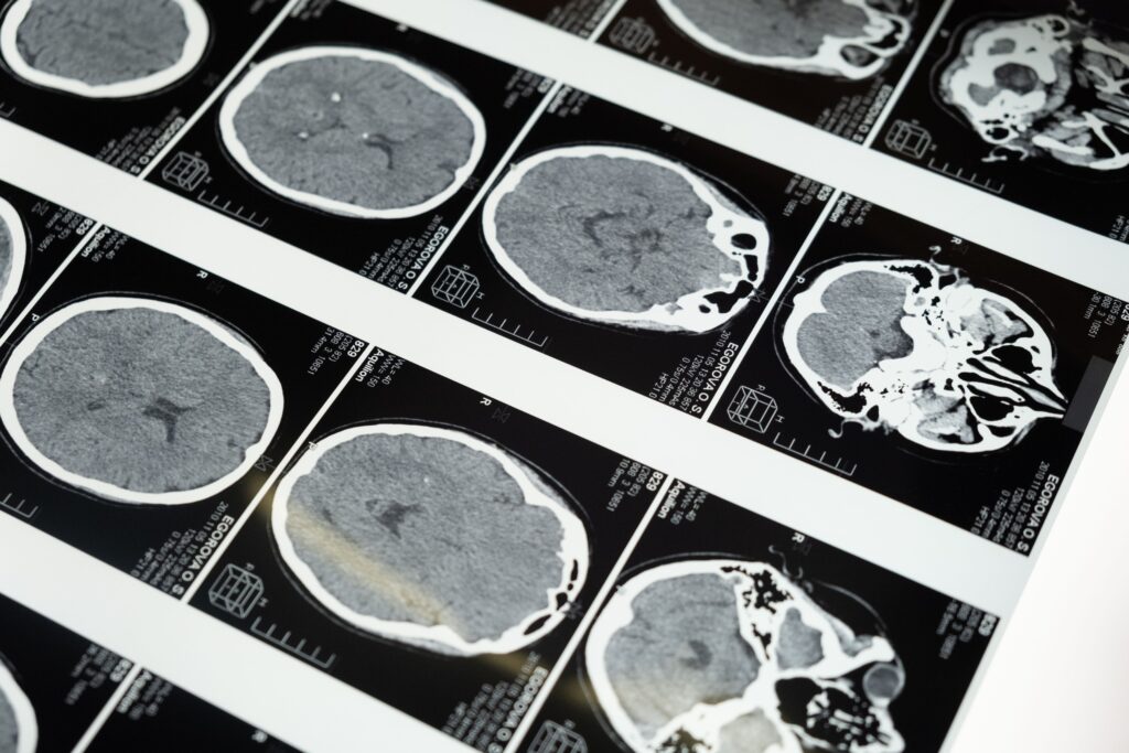 Ilustración de actividad cerebral que representa la validez científica del tratamiento